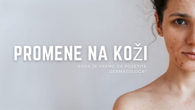 Devojka sa promenama na koži